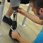 prosthetic leg for new amputee in Cairns